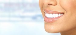 Consultation Appointment for Dental Veneers | Dental Veneers – Preparing for your Appointment