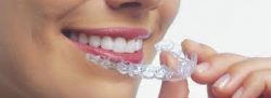 Orthodontic Treatment for Adults