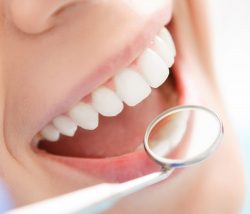 Teeth whitening(Bleaching) – Dental Treatment