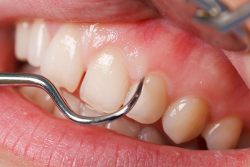 Benefits of a Dental Cleaning | DC Dentist – Vajdi Dental