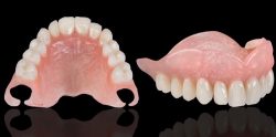 Denture Replacement |Full and Partial Dentures Near Me