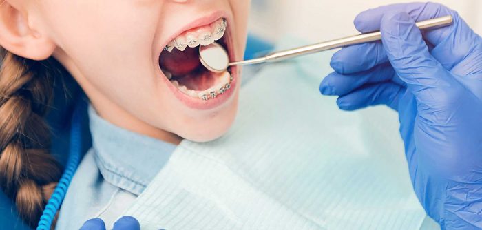 Best Dentist For Braces Near Me