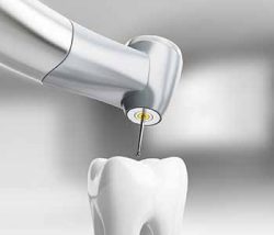 Root Canal Treatment Specialist Near Me | Find an Endodontist Near You