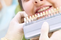 Affordable Teeth Whitening Houston