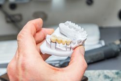 Affordable Dental Implants – Implant Secured Denture
