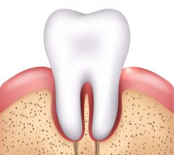 Tooth Extraction Services – Wisdom Teeth / Oral Surgery in Houston, TX