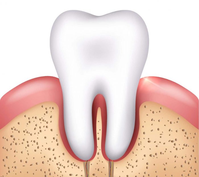 Tooth Extraction Services – Wisdom Teeth / Oral Surgery in Houston, TX