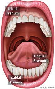 What is a Frenectomy and When is it Necessary?