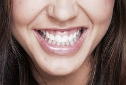 Gum Surgery Near Me In Houston, TX | Gum Surgery Cost In Houston