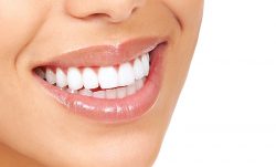 Dental Cleaning and Polishing | Tooth Polishing Procedure