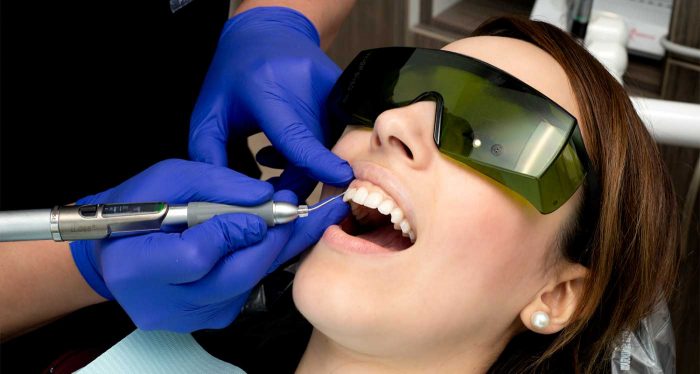 Laser Cosmetic Gum Reshaping | Soft Tissue Lasers: Gingivectomy