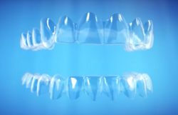 Invisalign Treatment Near Me in Miami | Invisalign doctors & clinics in Miami