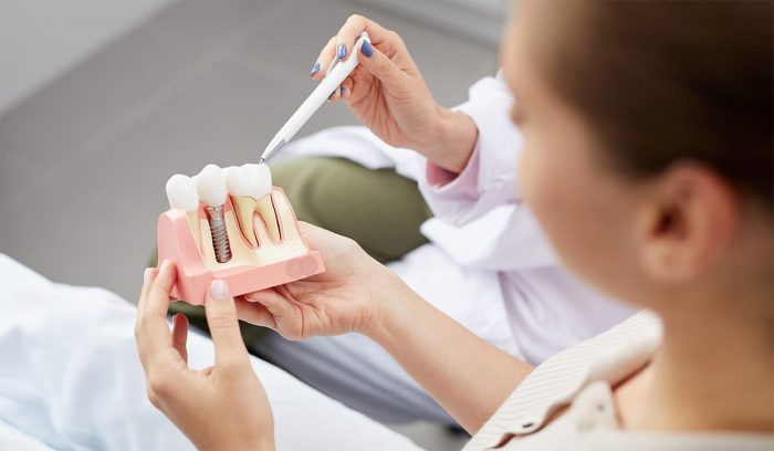 Affordable Dental Implants in Houston TX ` | Houston’s Premier Dentistry