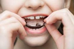 Kids Orthodontics Treatment Near Me