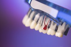 Cosmetic Dentist Uptown |dentistveneershouston