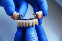 Restorative Dentistry Houston TX | Cosmetic & Implant Dentistry