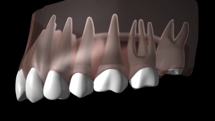 Wisdom Teeth Removal Near Me Houston, TX