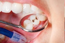 Tooth Inflammation Treatment Options | nearestemergencydentist