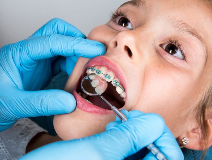 Kids Orthodontics Treatment Near Me | Child Dentist Near Me