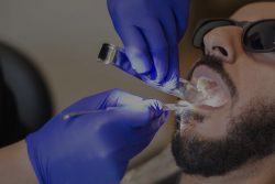 Tooth Extraction Houston | Tooth Extraction Houston | Dental Spa in Uptown Houston