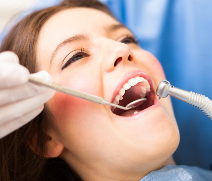 Restorative Dentistry Houston TX | Restorative Dental Treatments