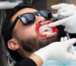 Dentist in Houston, TX 77084 | Best Dentist For Dental Implants