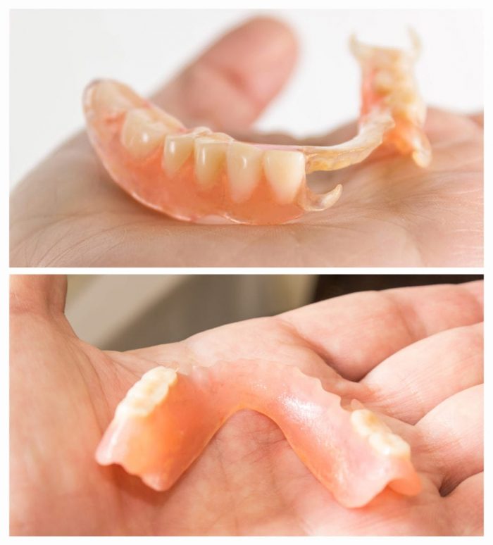 Dentures near me | Partial Dentures Houston Texas