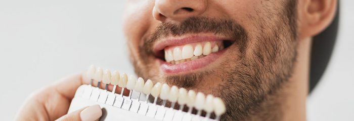 Dental Veneers Cost Houston | Veneers Teeth Cost Texas