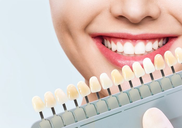 Dental Veneers Near Me | Cosmetic Dentistry Clinic