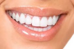 Tooth Filling Near Me | Types of Dental Fillings | Ceramic Fillings
