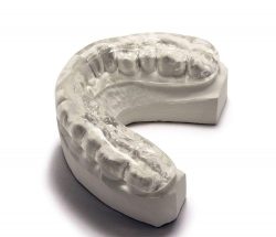 Night Guard For Teeth Grinding | mouthguards for grinding teeth
