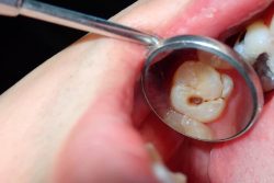 Periodontal Disease Treatment | Dental Clinic in Uptown Houston | periodontal ligament