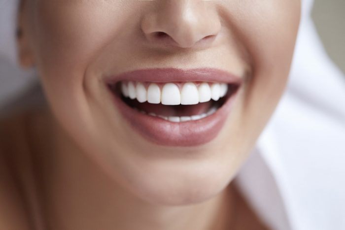 Dental Clinic In Houston Tx | cost of veneers