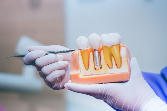 Dentist in Houston, TX 77079 | Emergency Dentist