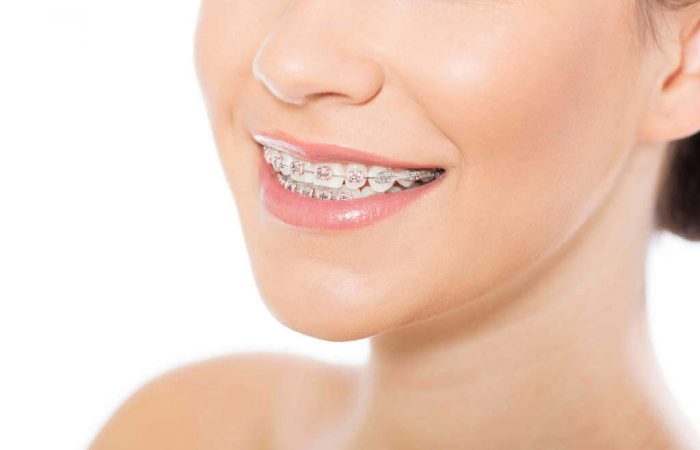 Find The Best Orthodontist | Highly Skilled Dentists In Miami Fl