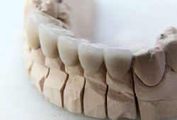 Tooth Restoration Dental Services in Houston,TX