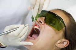 Laser Dentistry Near Me Houston