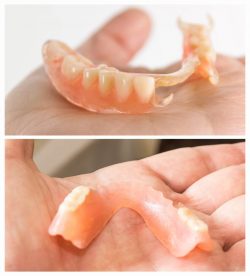 Dentures near me | Partial Dentures Houston