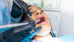 Find The Best Dentist in Houston, TX 77008 | General Dentists