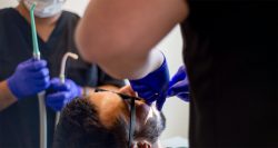 24 Hour Emergency Dental Extraction in Houston