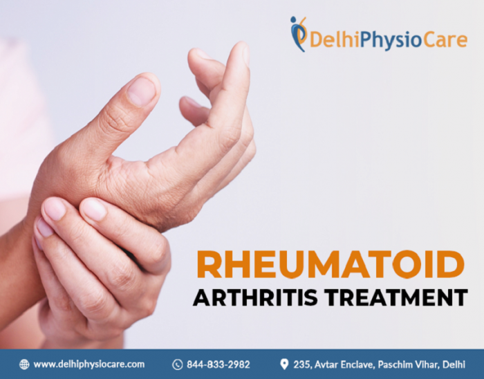 Rheumatoid Arthritis Treatment