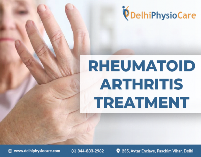 Rheumatoid Arthritis Treatment