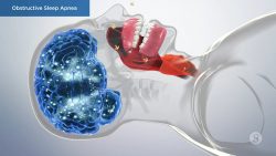 Why Seeing A Sleep Apnea Doctor In Houston Is Important
