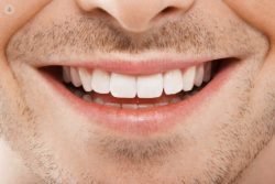 Full Mouth Restoration Near Me In Houston | Edge Dental