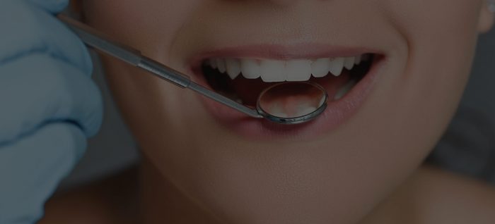 Full Arch Dental Implants Near Me In Houston