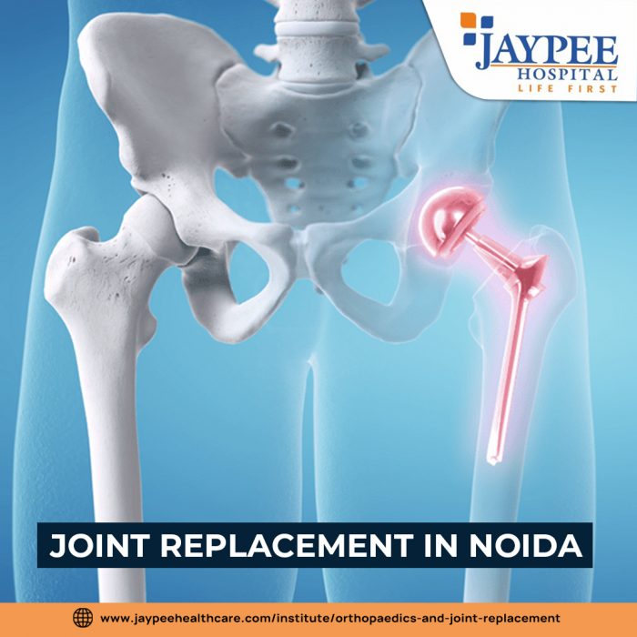 Find the Best Knee Doctors in Noida | Jaypee Hospital