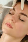 Rejuvenate Your Look with BOTOX in Johnstown, CO – Lash and Company