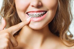 Expert Orthodontics in Lake Ridge – Achieve a Perfect Smile