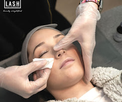 Revitalize Your Skin with Skin Rejuvenation in Lakeview, IL – Lash and Company