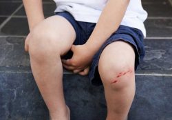 Dog Bite Attorney Fort Worth – Legal Support from Mizani Law Firm